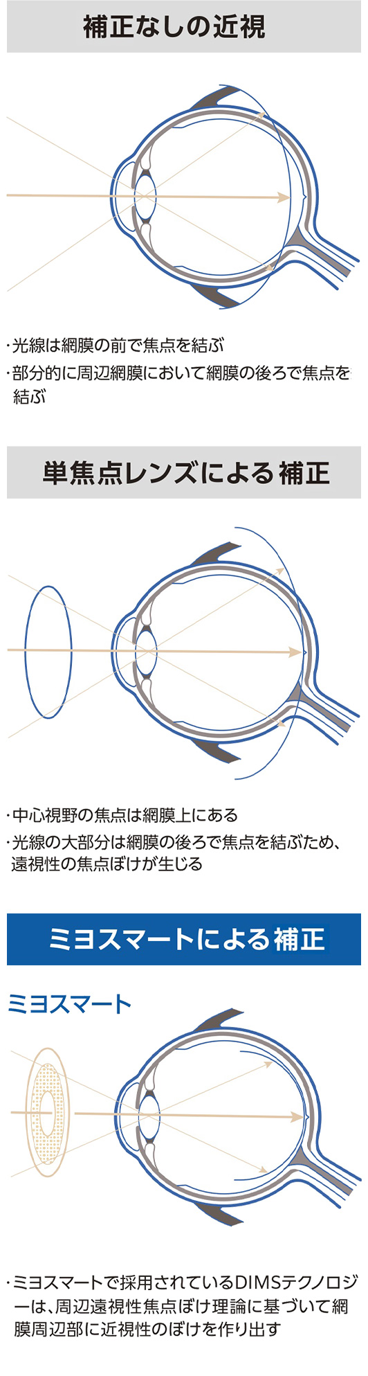 ミヨスマートについて