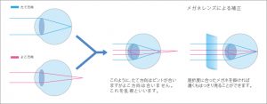 乱視図