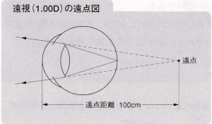 遠視