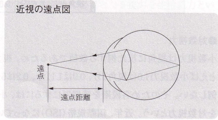 近視